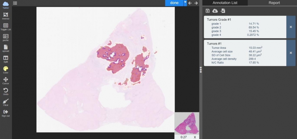 Intelligent Precision Medicine Aid System